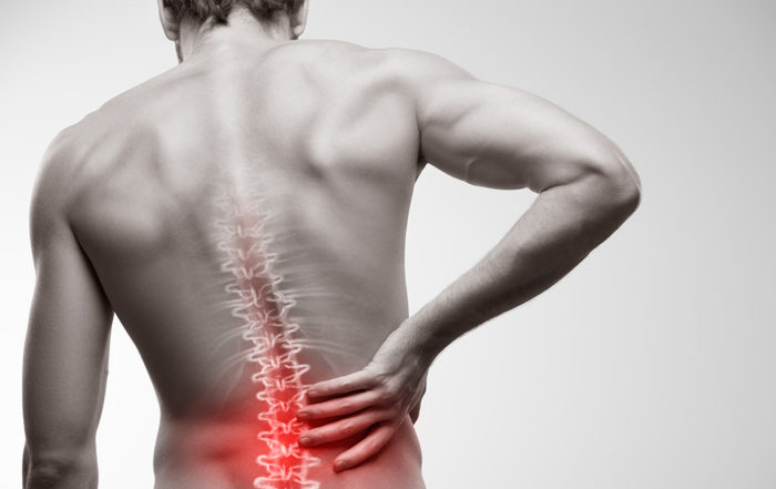 Back Injury at Work - BTLawyers